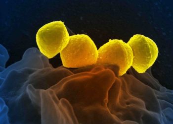 Japan reports record spike in potentially deadly bacterial infection
