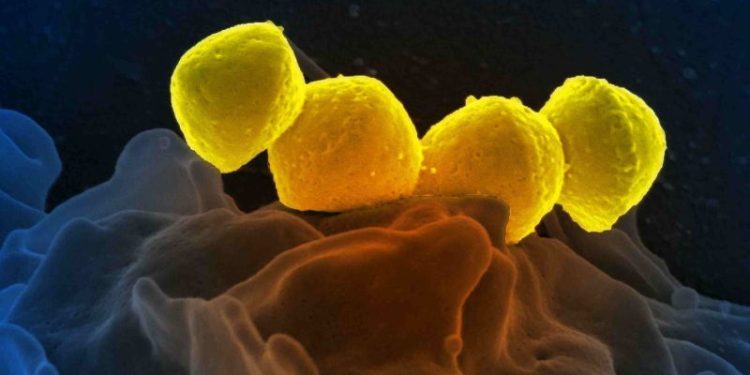 Japan reports record spike in potentially deadly bacterial infection