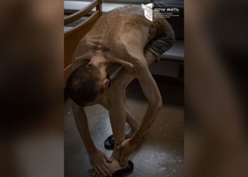 Photos of released Ukrainian prisoners of war show emaciated bodies in ‘horrifying’ condition