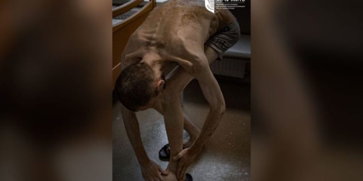 Photos of released Ukrainian prisoners of war show emaciated bodies in ‘horrifying’ condition