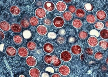 Sweden confirms first case of mpox