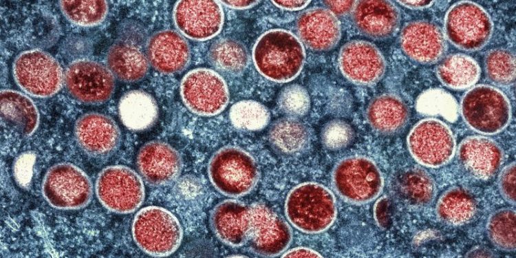 Sweden confirms first case of mpox