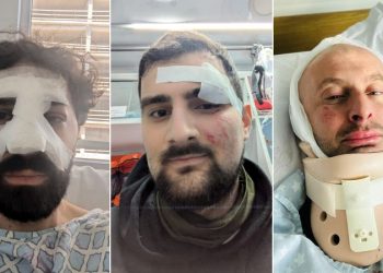 Georgian protesters detail brutal beatings by special forces