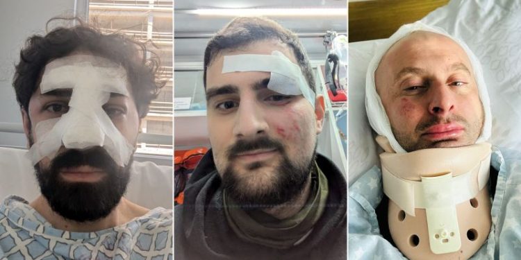 Georgian protesters detail brutal beatings by special forces